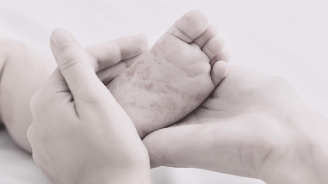 Aumentan a 22 los casos de sarampión en Tomatlán; se refuerza la vigilancia epidemiológica en la zona