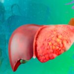 Los mejores y peores quesos para cuidar tu hígado graso: ¡Descúbrelos!