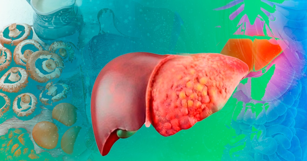 Los mejores y peores quesos para cuidar tu hígado graso: ¡Descúbrelos!