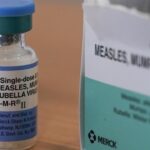 Tres casos de sarampión importados confirmados en Bahía de Banderas; intensifican medidas epidemiológicas