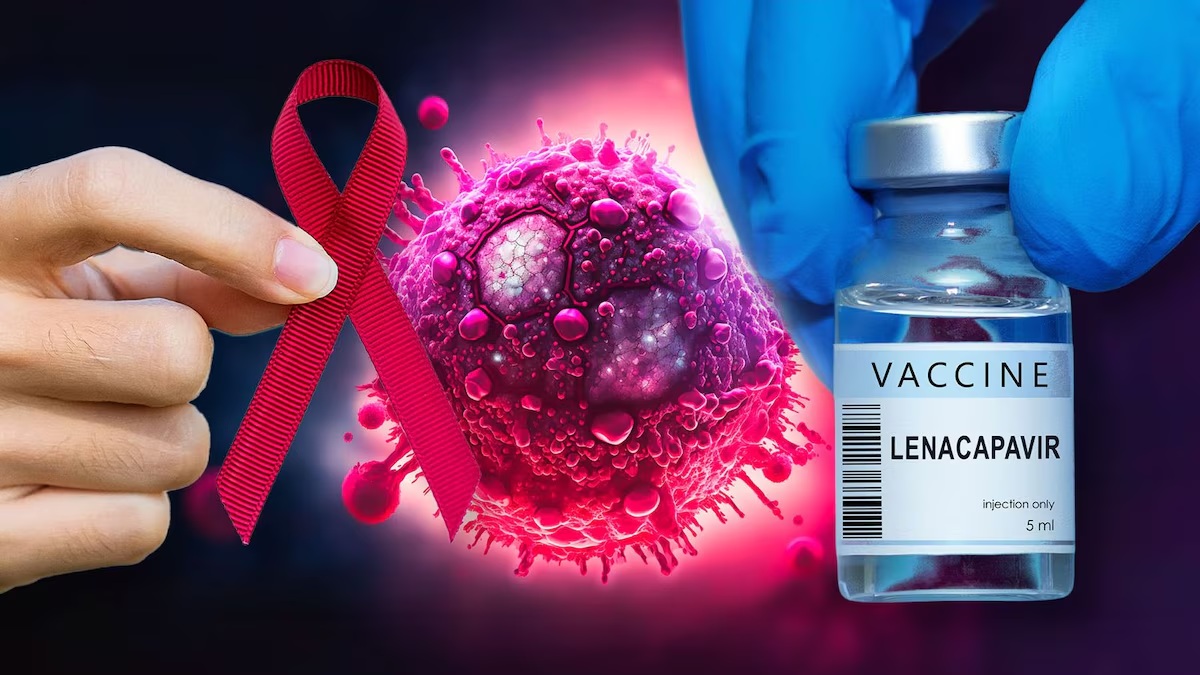 Una nueva esperanza en la prevención del VIH: Lenacapavir