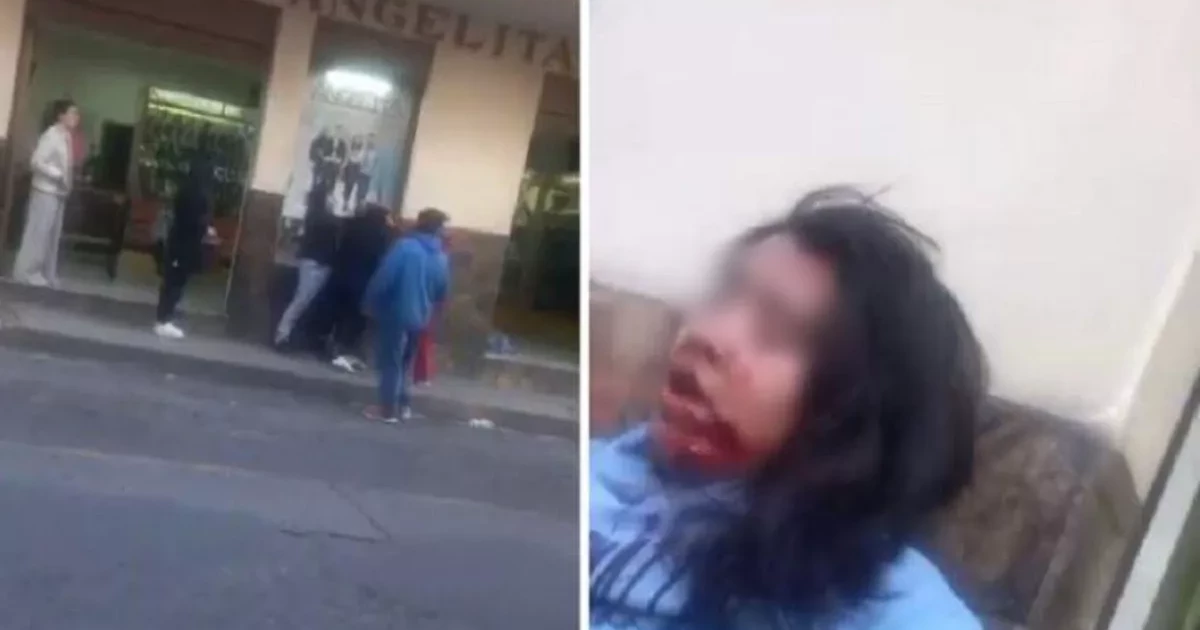 Impactantes imágenes: ¡Mujer muerde el cachete de otra en pelea en Michoacán!